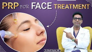 PRP for face  PRP for face treatment  PRP for face benefits  PRP treatment for face cost in India [upl. by Arihk341]