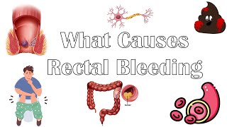 What Causes Per Rectal Bleeding Major Causes Of Blood In Stools Rectal Bleeding Causes [upl. by Enicul]