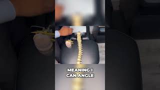 C5C6 Disc Bulge Treatment How Spinal Decompression Works  Dr Ruminder Birk [upl. by Oiramad14]