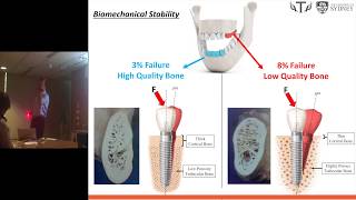 Biomechanical Analysis of a Dental ImplantJawbone Biomechanical System FEA [upl. by Becka]