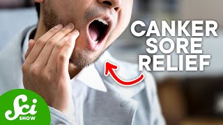 How to Get Rid of Canker Sores According to Science [upl. by Binky]