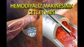 Hemodiyaliz Makinesinin Setlenmesi [upl. by Nurse]