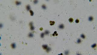 The Haematococcus pluvialis [upl. by Euf282]