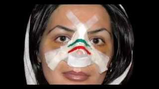 Mahlagha Jaberi is Realllwith her plastic photoshopped face and colored contacts [upl. by Enreval]