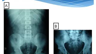 Urologic Investigations  urology  6th grade  Dr Islam Farouk [upl. by Lativa]