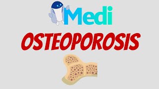 ¿Cuándo tamizar Osteoporosis [upl. by Dnomad737]