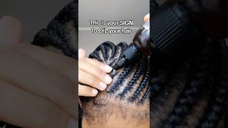 Should you apply oil on the scalp braids scalp naturalhair [upl. by Siberson890]