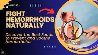 Haemorrhoid Healing Top Foods to Include in Your Diet [upl. by Geraud]