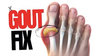 Gout Relief Natural Solution [upl. by Clarisse749]