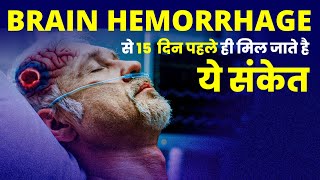 ब्रेन हेमरेज क्या होता है और कैसे होता है  What Happens in Brain Hemorrhage [upl. by Eikcin]