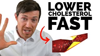 The BEST Way to Lower Cholesterol If You Have Hypothyroidism [upl. by Popelka833]