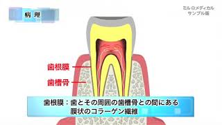 歯根膜炎／ミルメディカル 家庭の医学 動画版 [upl. by Ellahcim627]