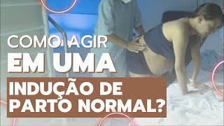 Como agir em uma Indução de Parto [upl. by Eznyl200]