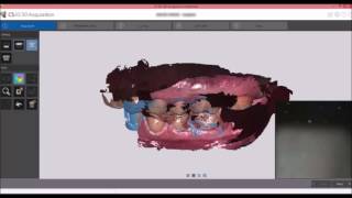 CS3600 Carestream Dental [upl. by Maurili]