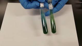 Simmons Citrate Test [upl. by Swamy327]