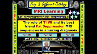 The role of T1 and its best friend fat suppression sequences in amazing diagnosis Part 1 [upl. by Ssirk]