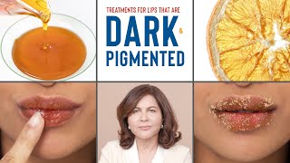 How To Treat DARK PIGMENTED Lips  Dermatologists Advice [upl. by Ahsanat413]