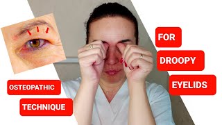 One easy OSTEOPATHIC technique for DROOPY EYELIDS [upl. by Pederson398]