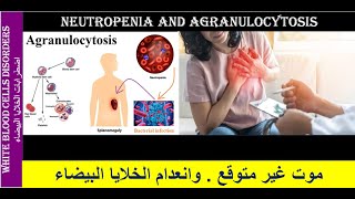 Lecture 23 Neutropenia and Agranulocytosis [upl. by Aitnuahs183]