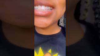 Teeth gems so fun gemzeez [upl. by Claudette]