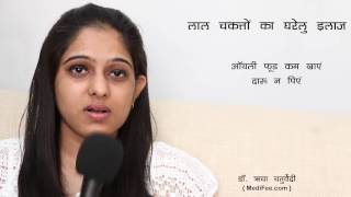 Skin Rashes  Signs Symptoms Home Remedies and Prevention Hindi [upl. by Tremaine]