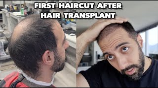 FIRST HAIR CUT AFTER A HAIR TRANSPLANT [upl. by Plusch]