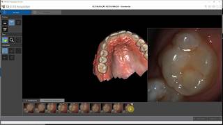 Fotos em full HD intraoral com o Scanner Intraoral CS 3600 da Carestream [upl. by Posehn759]