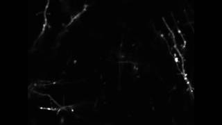 Dendrites and dendritic spines in the mouse cortex [upl. by Matty967]