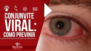 Como se prevenir de Conjuntivite viral Dr Marcos de Castro [upl. by Imuya681]