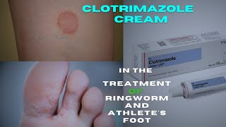 Clotrimazole cream An Effective Antifungal Cream for Ring worm  Treatment and Usage [upl. by Tizes]