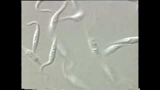 Trypanosoma [upl. by Ikik]