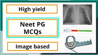 Neet Pg MCQ Pediatric subject high yield mbbs neetpgpreperation pediaticlectureformedicalstudent [upl. by Ydda99]