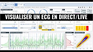 Visualiser le tracé ECG en live [upl. by Gaskill]