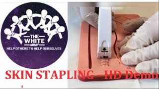 SKIN STAPLING  HD Demonstration [upl. by Ennaid686]