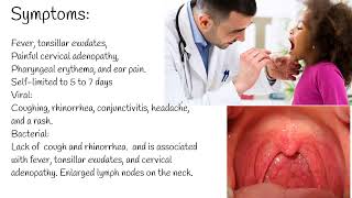 Pharyngitis  Symptoms causes and Treatment Streptococcal pharyngitis [upl. by Eelah]