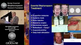 Myectomy Surgery for Blepharospasm Richard L Anderson MD Tribute Lecture Dr John Holds MD [upl. by Atiran631]