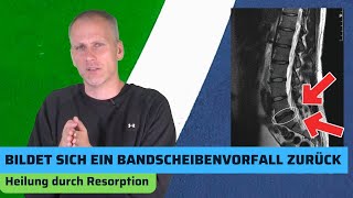 Bandscheibenvorfall verschwunden Ist eine Heilung möglich Resorption [upl. by Silas]