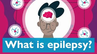 What is epilepsy [upl. by Rahas]