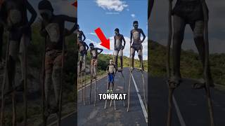 Kenapa mereka berjalan menggunakan tongkat‼️😱 [upl. by Kus201]