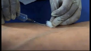 Phlebotomy venipuncture procedure Dr Sanjay D Deshmukh MD [upl. by Cloe]