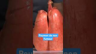 Poumon de fumeur VS non fumeur [upl. by Analeh]