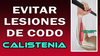 Evitar Lesiones de codo en Calistenia  Epicondilitis medial [upl. by Aemat]