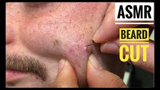 ASMR Beard Cut • İngrown Beard and treatment• Sakal TrasKıl Dönmesi [upl. by Gargan]