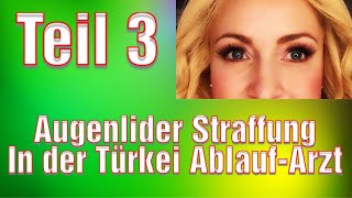 Augenlidstraffung Türkei Erfahrung Medical Exclusive Vorher Nachher Schlupflider entfernen [upl. by Nickie]