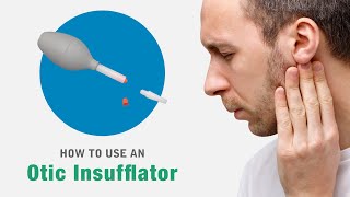 How to use an Otomed otic or ear insufflator device [upl. by Kudva543]