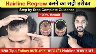 100 Result  Hairline Growth Tips 2023  Receding Hairline से छुटकारा [upl. by Weiman162]