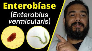 Enterobíase Enterobius vermicularis ciclo biológico  Oxiurus  Enterobiose  Parasitologia [upl. by Cirdor]