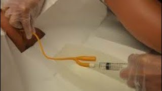 How To Flush Foley Catheter New Video  Catheter Flush Tips [upl. by Courcy796]