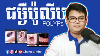 ជម្ងឺប៉ូលីបPolyps [upl. by Richara]