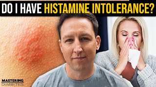 What is Histamine Intolerance And Why Should You Care  Mastering Diabetes [upl. by Winnifred759]